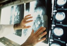 Ранняя диагностика и профилактика РМЖ и РШМ